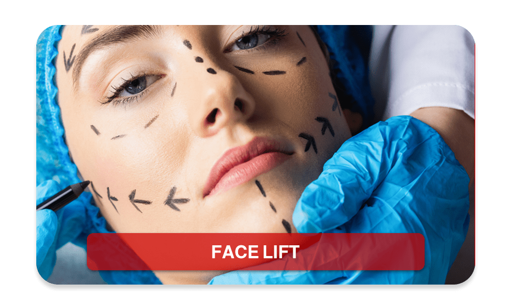 Facelift