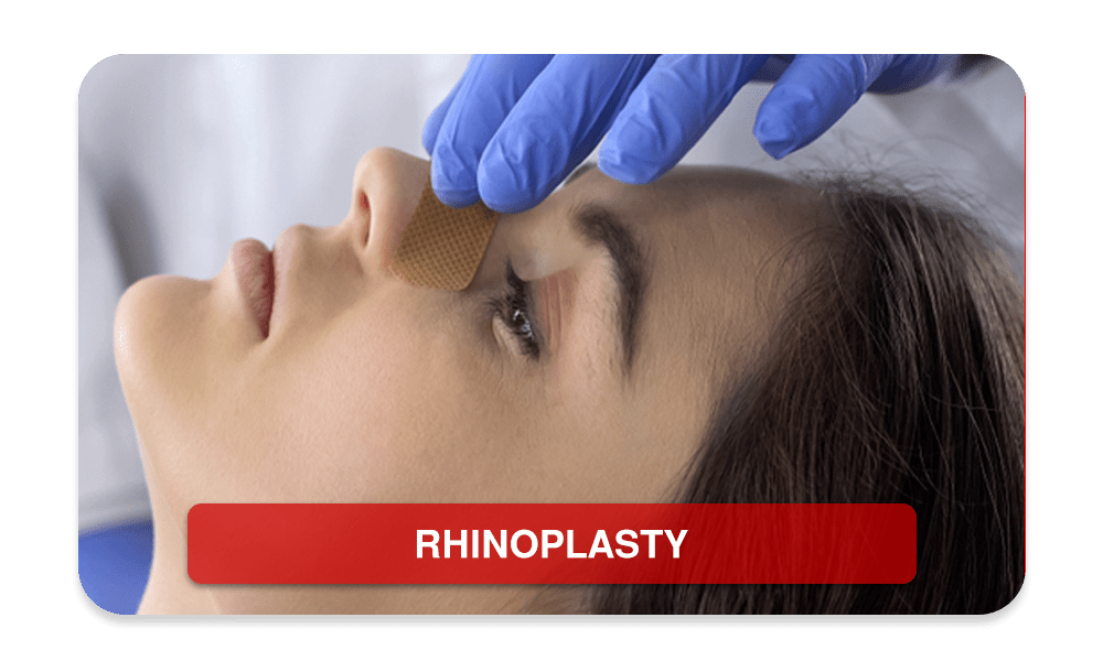 RHINOPLASTY