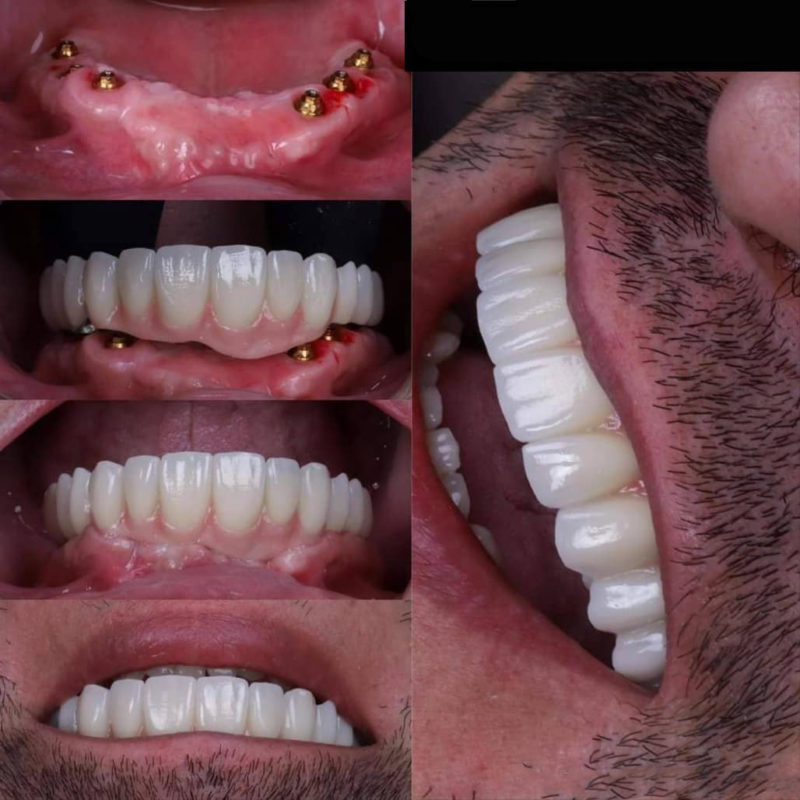 Dental Operations lunarclinic (32)