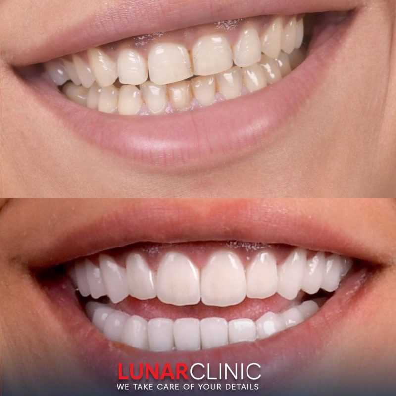 Dental Operations lunarclinic (46)