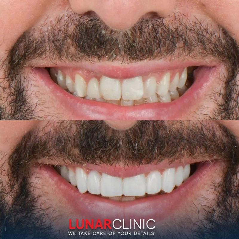 Dental Operations lunarclinic (5)