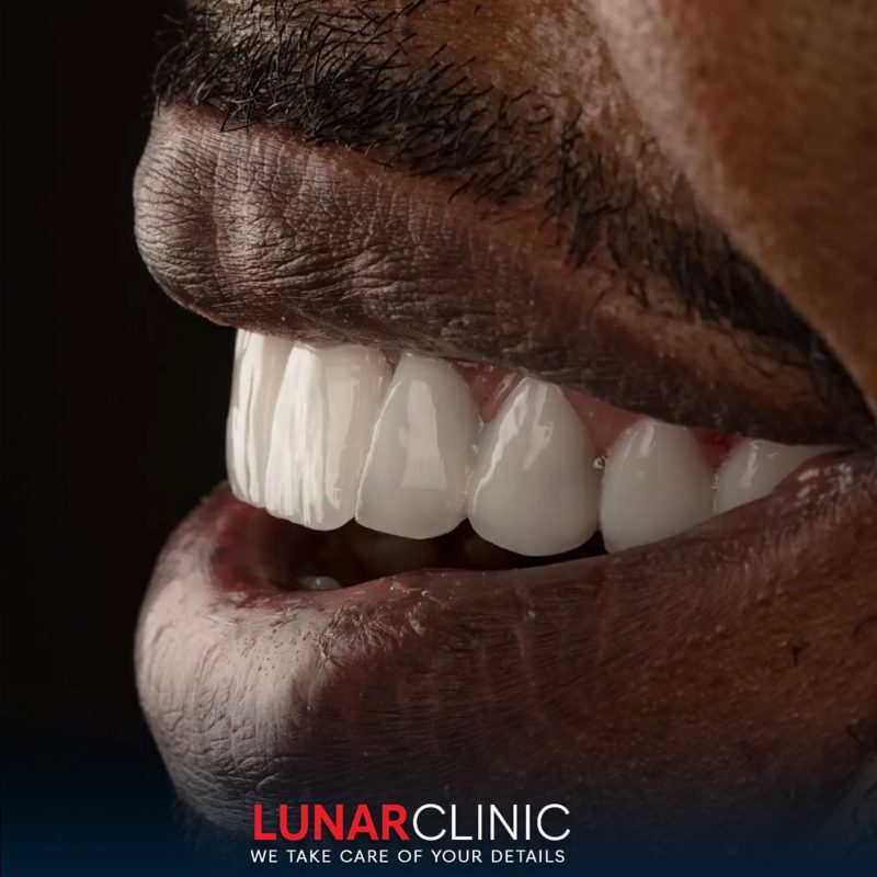 Dental Operations lunarclinic (7)