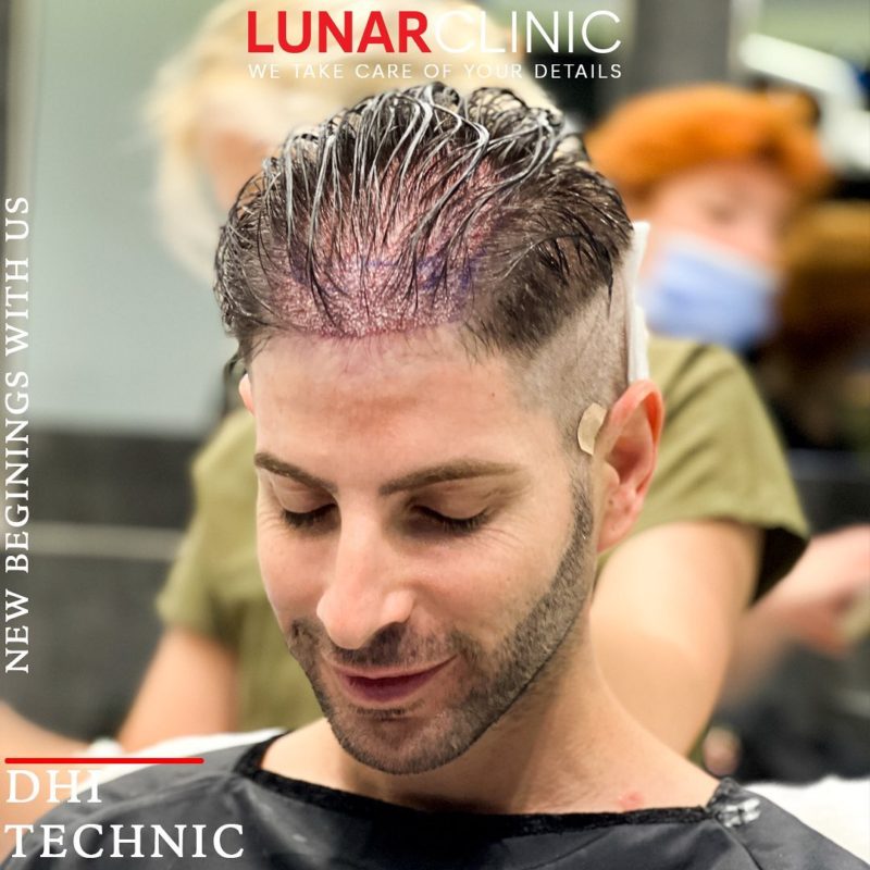 Hair Treatments lunarclinic (3)