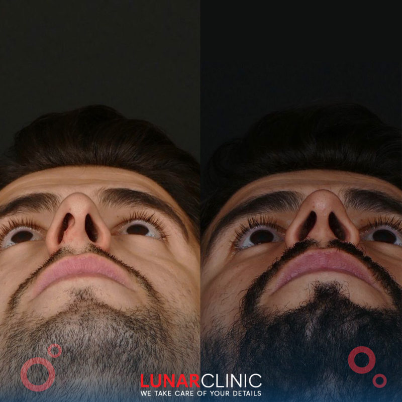 lunarclinic (11)