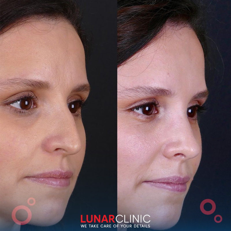lunarclinic (12)