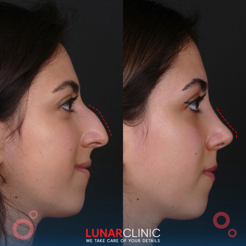 lunarclinic (6)
