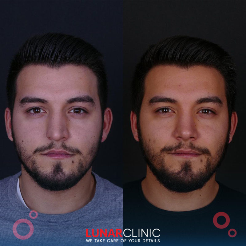 lunarclinic (9)